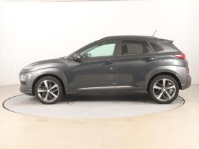 Hyundai Kona  1.0 T-GDI 