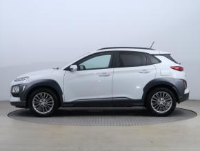 Hyundai Kona  1.0 T-GDI 