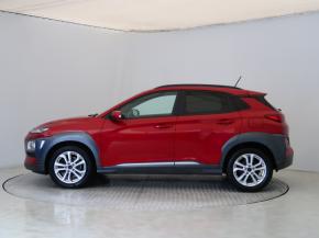 Hyundai Kona  1.6 CRDi 