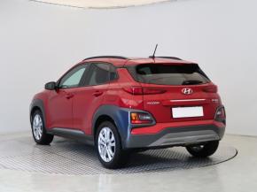 Hyundai Kona  1.6 CRDi 