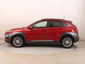 Hyundai Kona  1.0 T-GDI Mystic 